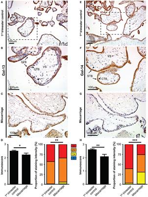 Frontiers | Placental Galectins Are Key Players In Regulating The ...